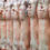 Meatworks employee hospitalised with leg injury after workplace accident